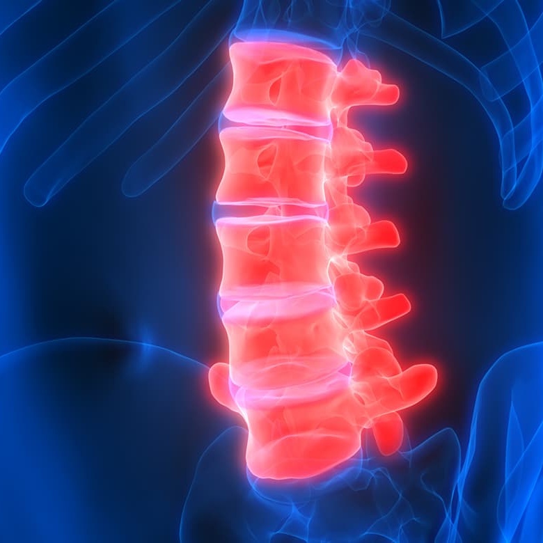 Spinal Cord Injuries Image