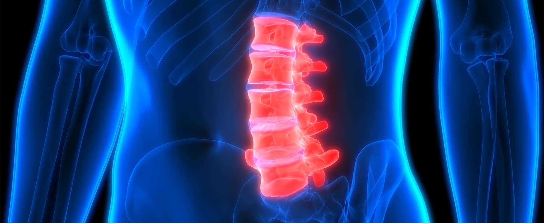 Spinal Cord Injuries Image