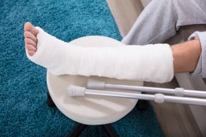 broken leg from car accident