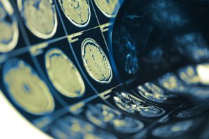 brain scans/xrays