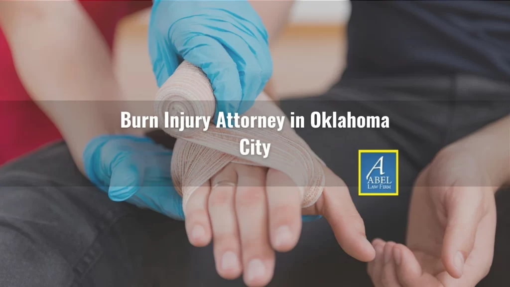 Pasadena Burn Injury Lawyer thumbnail