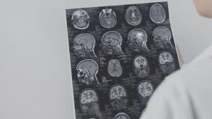 Traumatic Brain Injury Lawyer in Oklahoma City